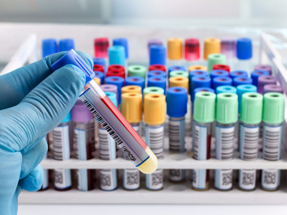 Special features of biosamples’ delivery to laboratory