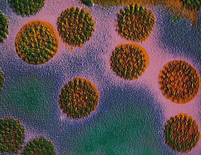 New vaccine against rotaviral disease to spare  thousands of lives