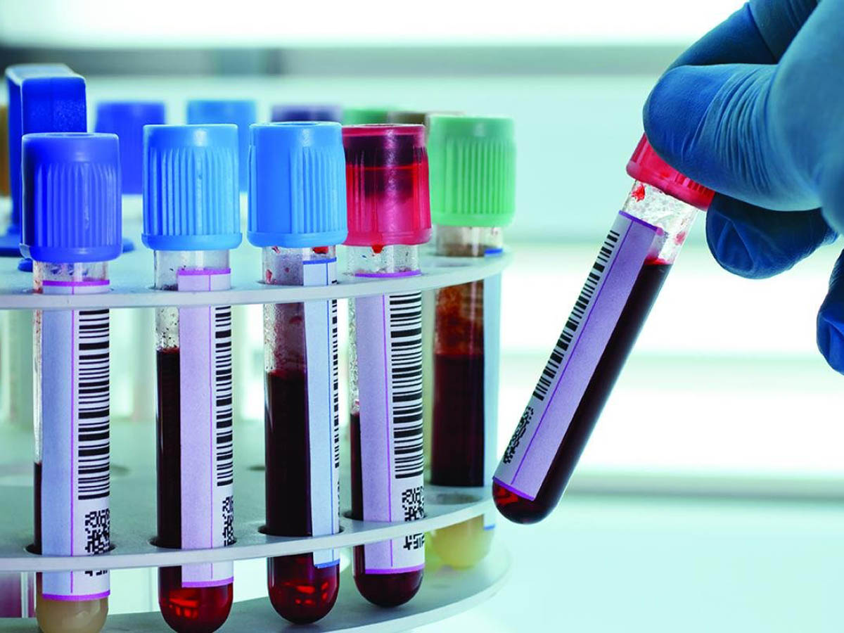 Biosamples and their storage